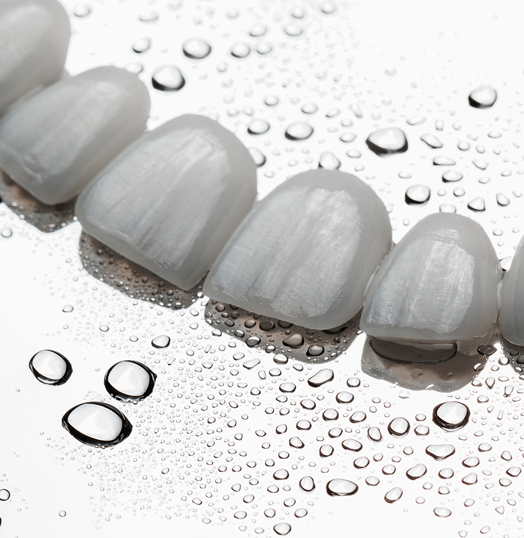 Porcelain veneers at Dr. James Slaman