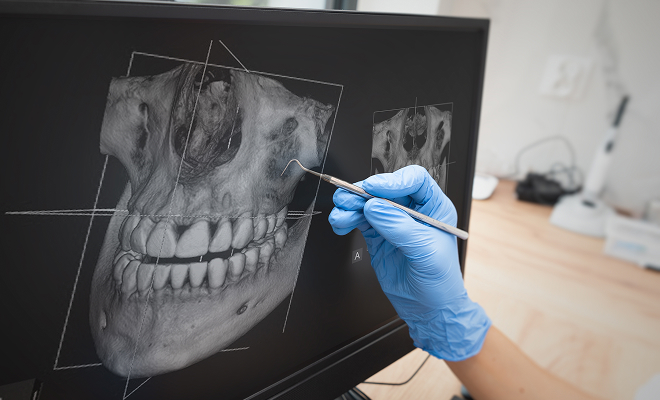 Jaw x-ray
