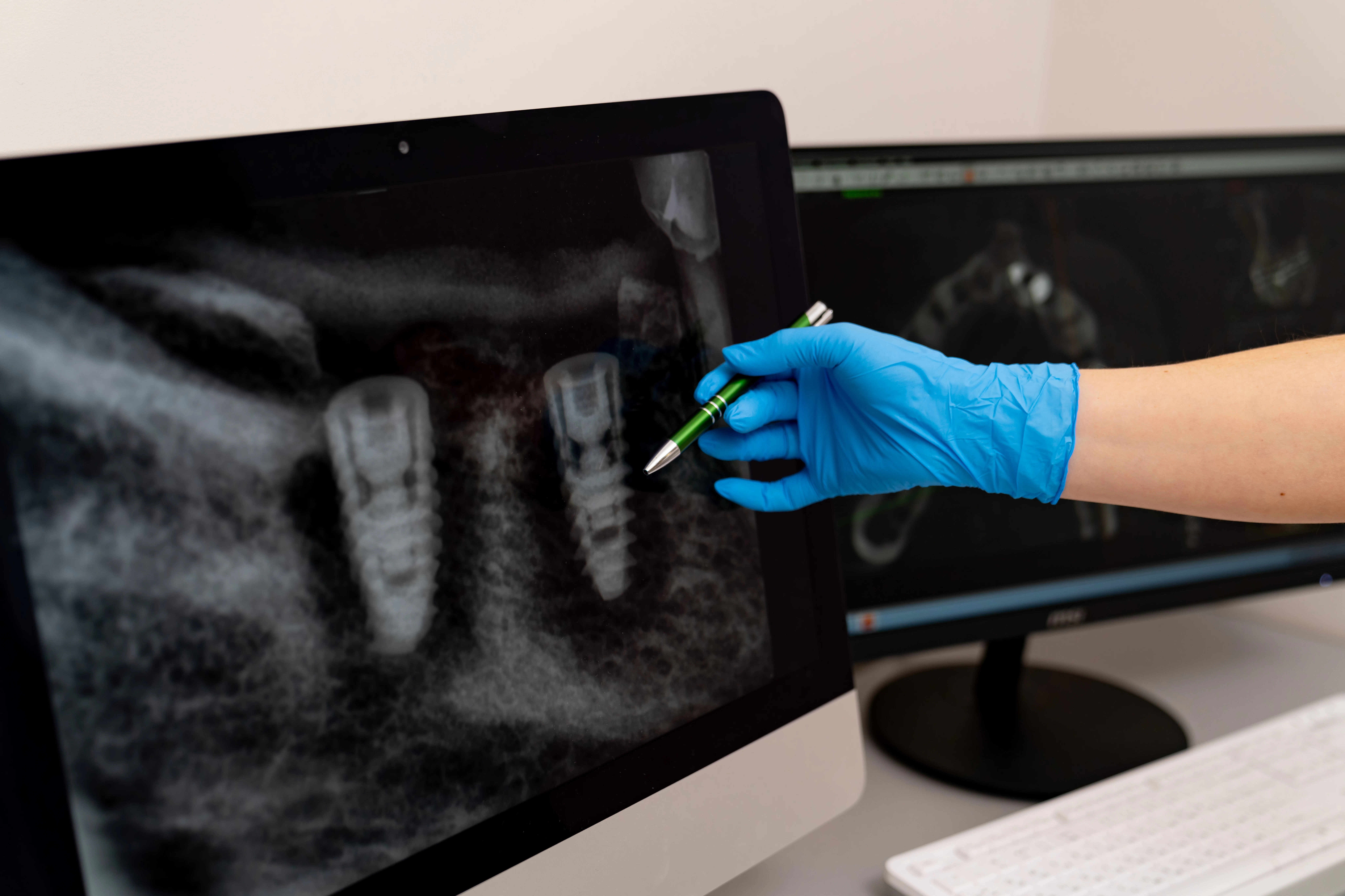 dentist reviewing X-rays on a screen