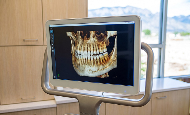 Digital Imaging at the dentist's office