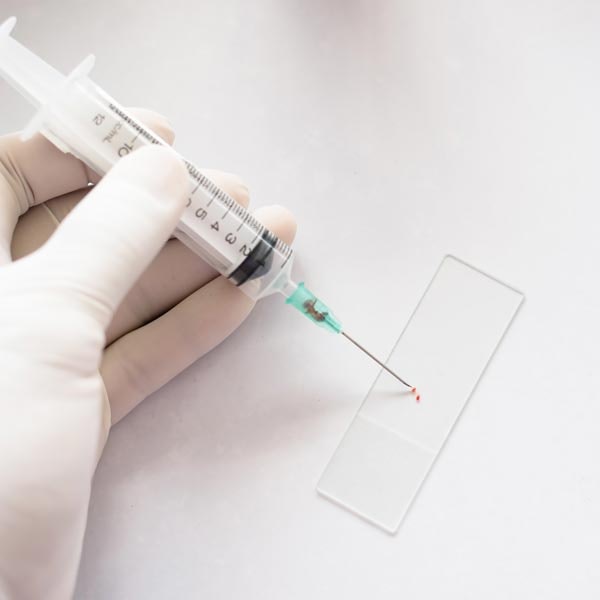 Syringe adding sample to a slide