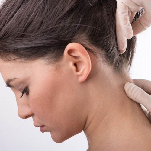 Doctor pinching the back of woman's neck with gloved hands