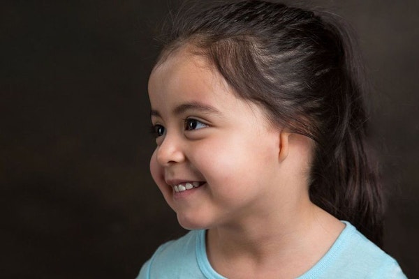 Little girl with misshapen ear smiling