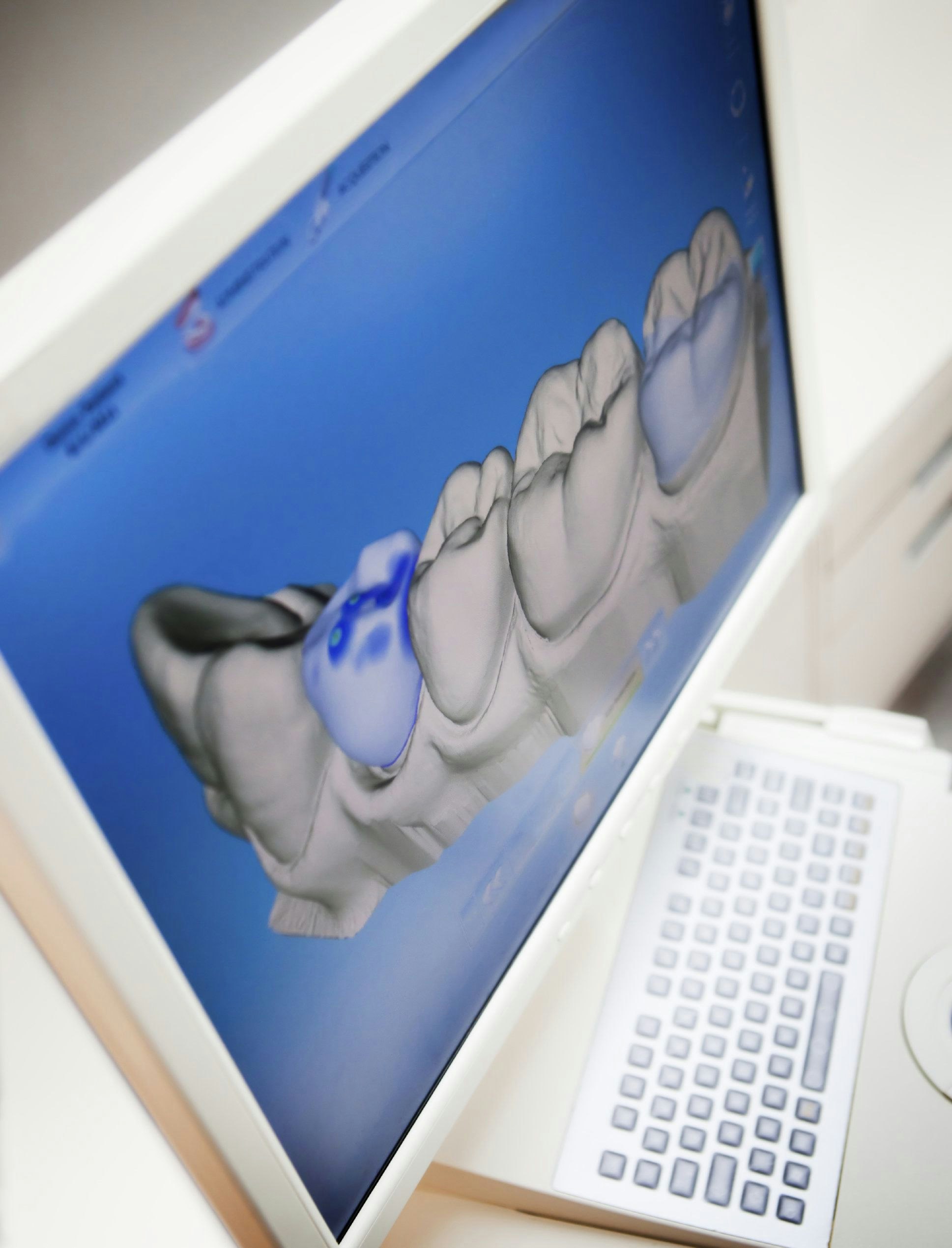 3D dental imaging