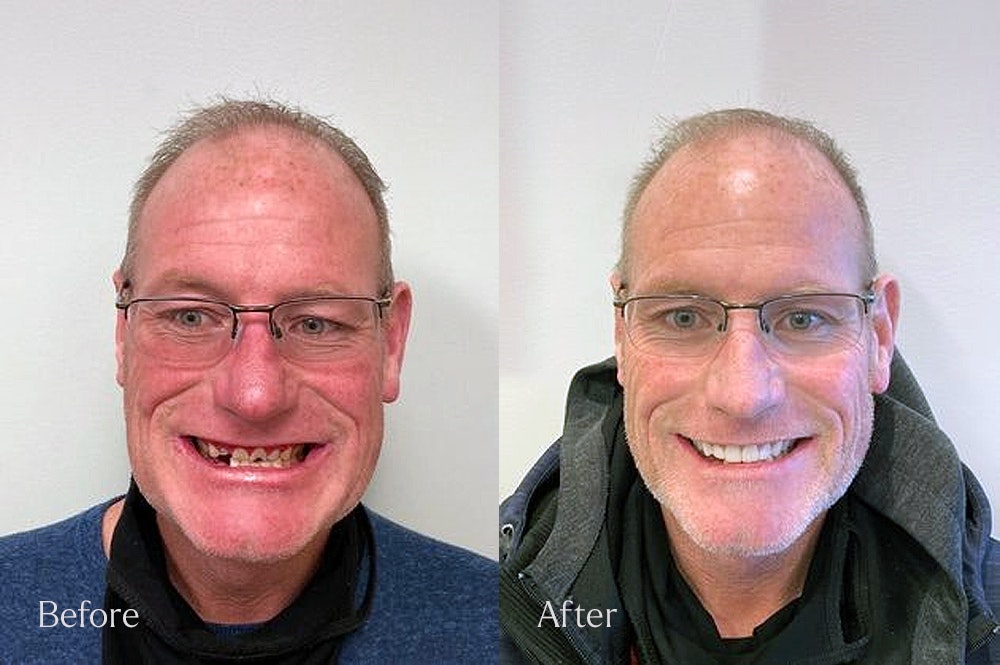 before and after photos of a customer