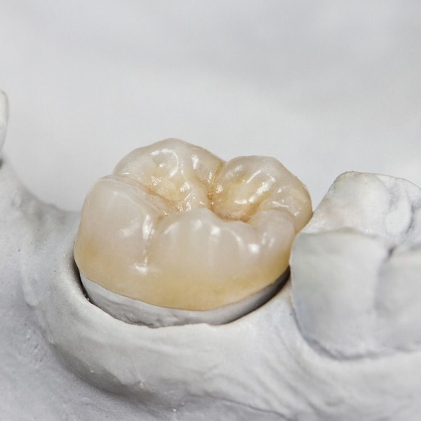 Dental crown on tooth mold