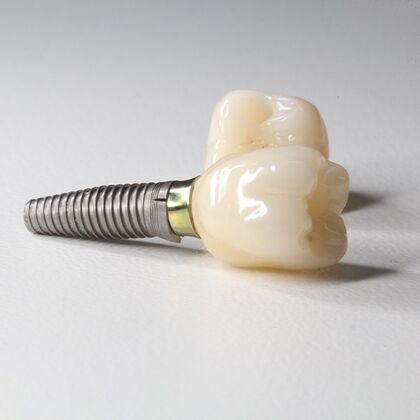Implant-supported crowns