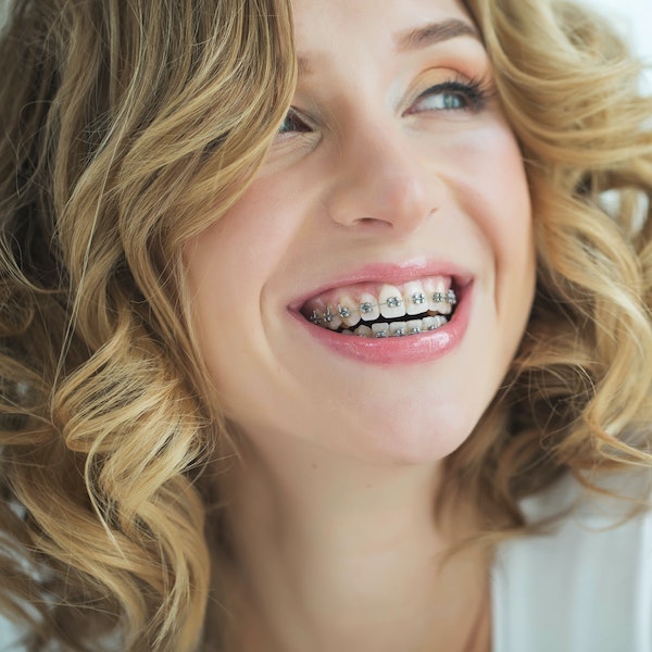 Teenage girl wearing traditional braces