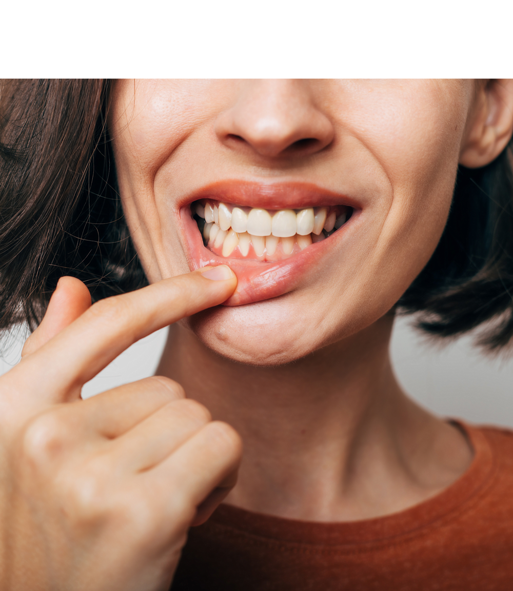 Gum Graft Orland Park, IL Premier Dental & Implant Center