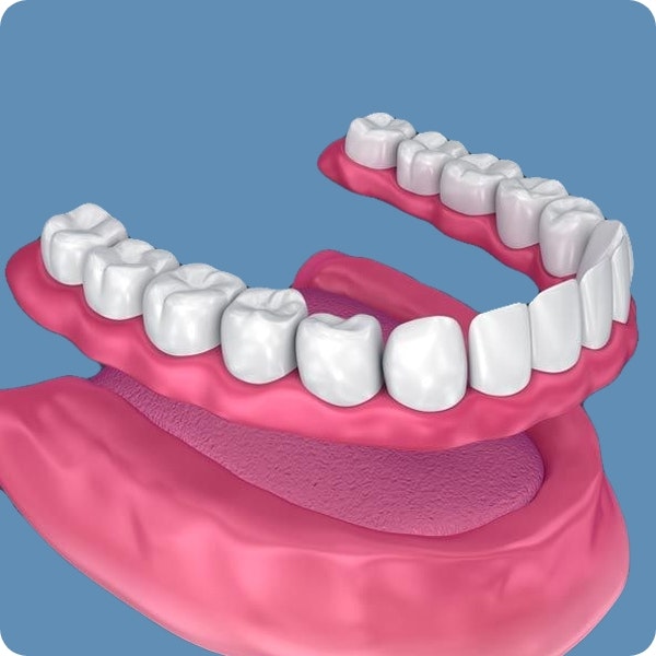 Full Dentures