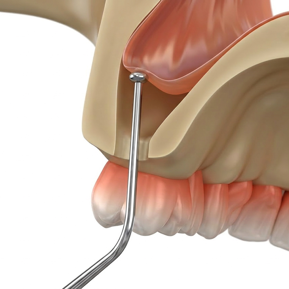 Dentist pointing to model skull to talk about sinus lifts