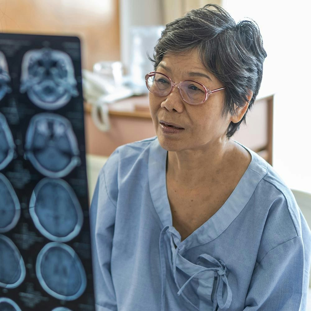 Older woman reviewing brain scans with a doctor