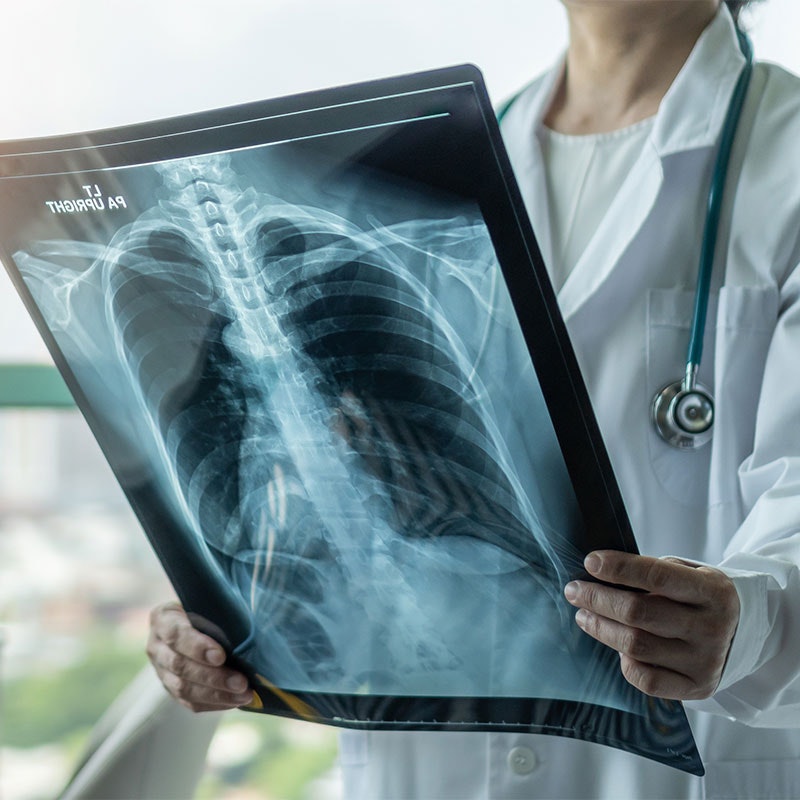 Doctor looking at an x-ray