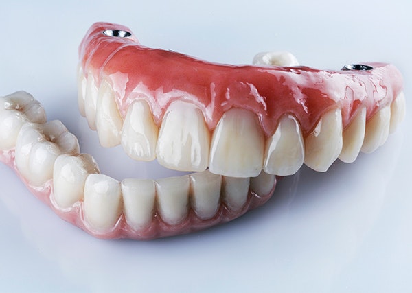 Implant-Supported Dentures