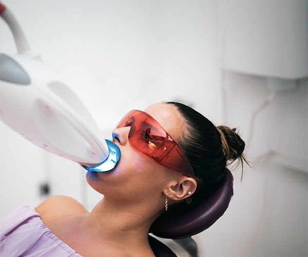 girl getting her teeth whitened at the dental office
