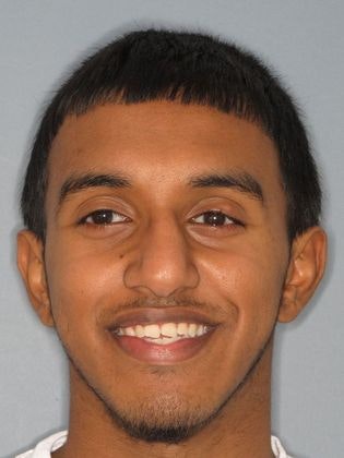  patient before Invisalign