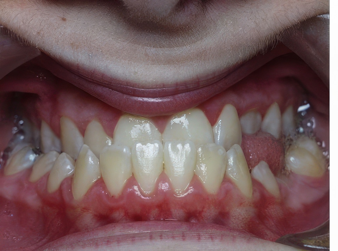 patient before treatment