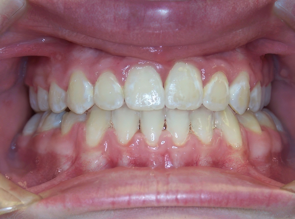 patient after treatment