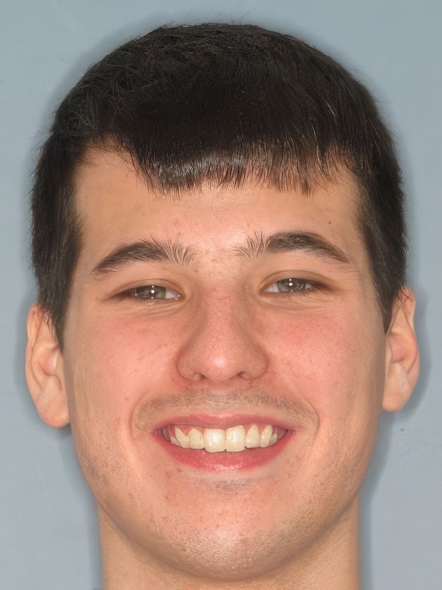 Kellyn Hodges patient before treatment