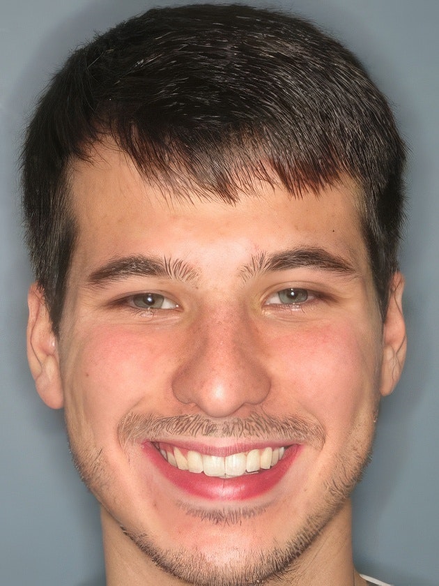 Kellyn Hodges patient after treatment