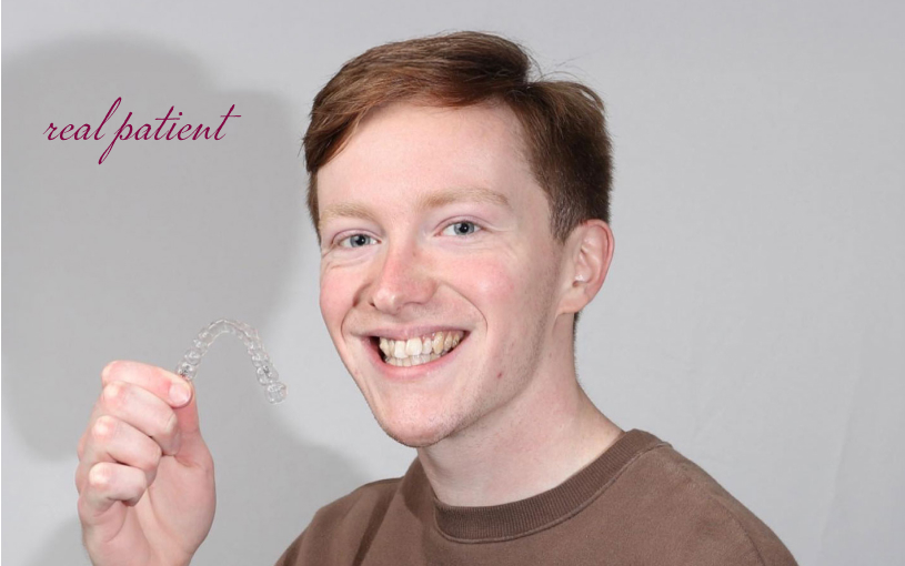 Invisalign aligner over teeth