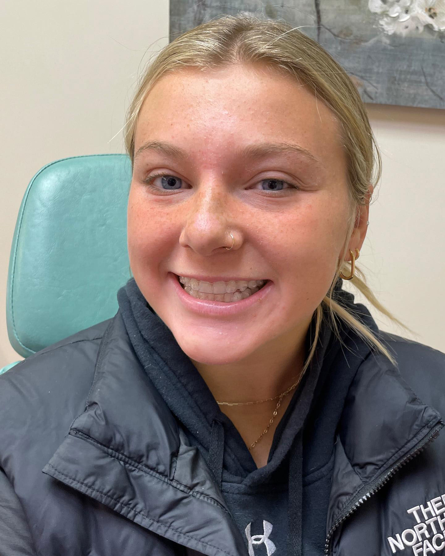 smiling Invisalign patient