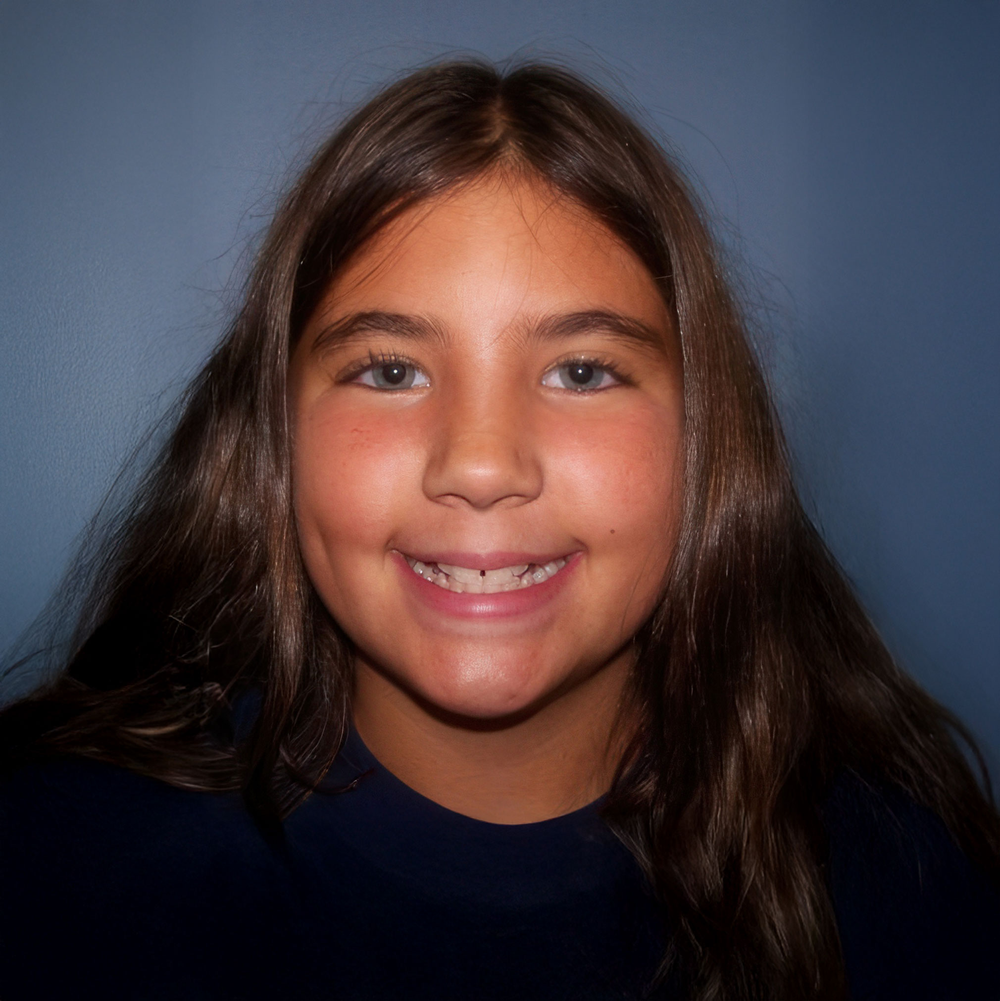 teen with spacing concerns