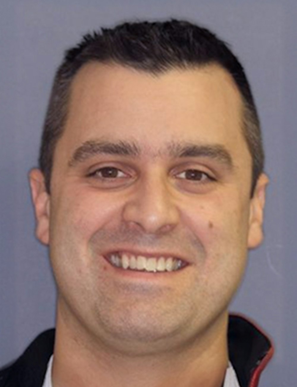 patient before Invisalign