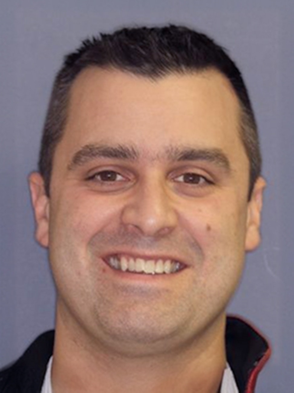 patient before Invisalign