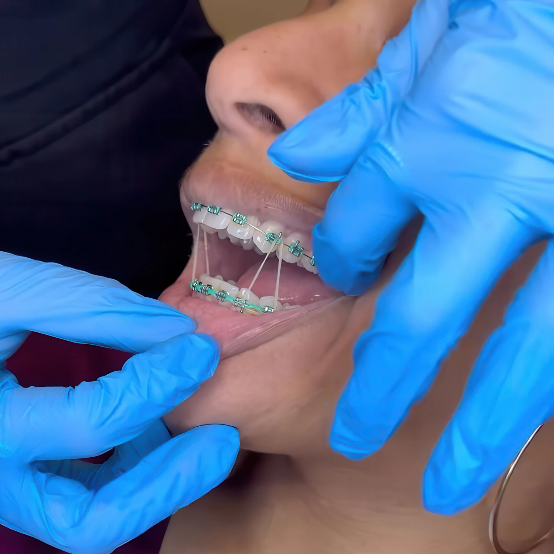 checking a patient