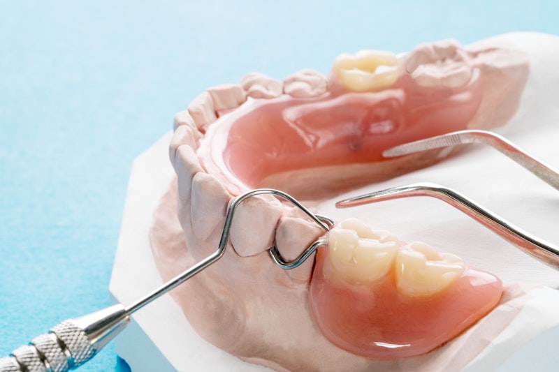 partial dentures