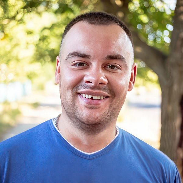man with chipped tooth