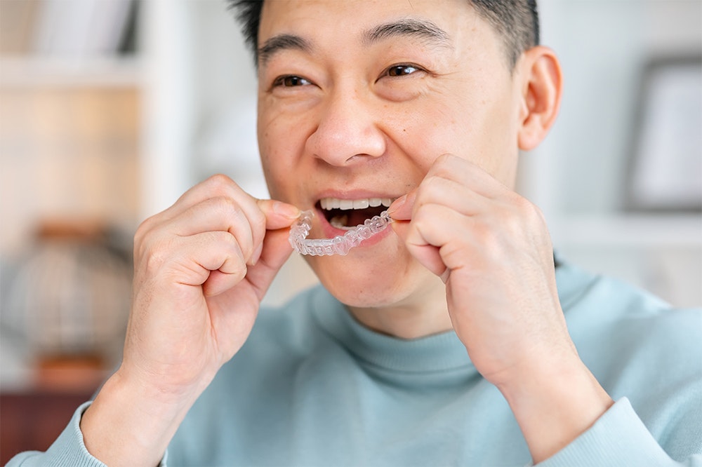 man using Invisalign