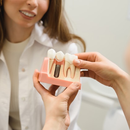 Dentist showing patient dental implant model