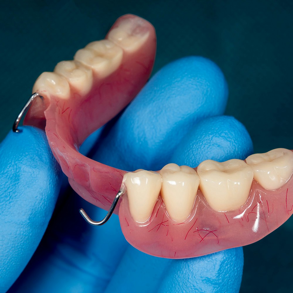 partial dentures