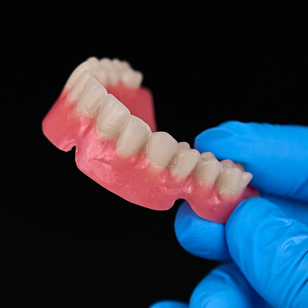 full-arch dentures