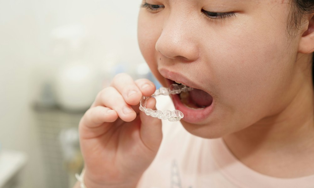 kid using a clear aligner tray