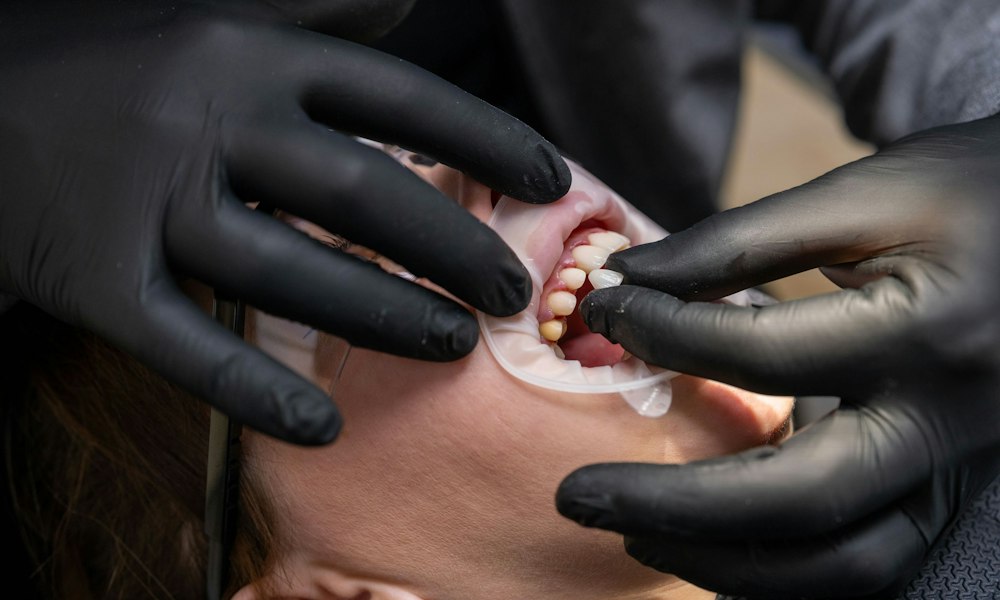 patient getting veneers