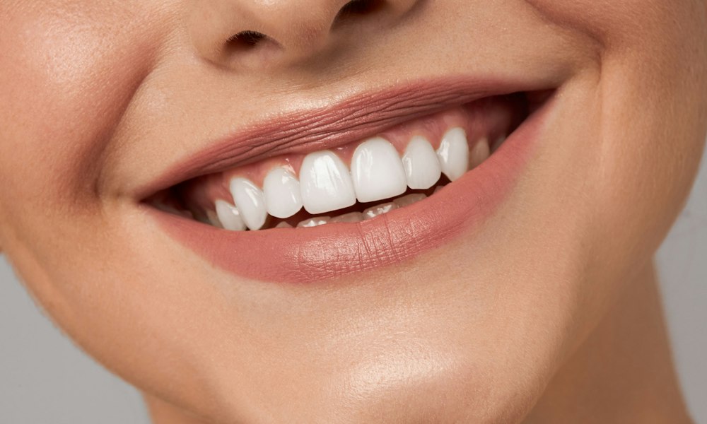 close up of white toothed smile