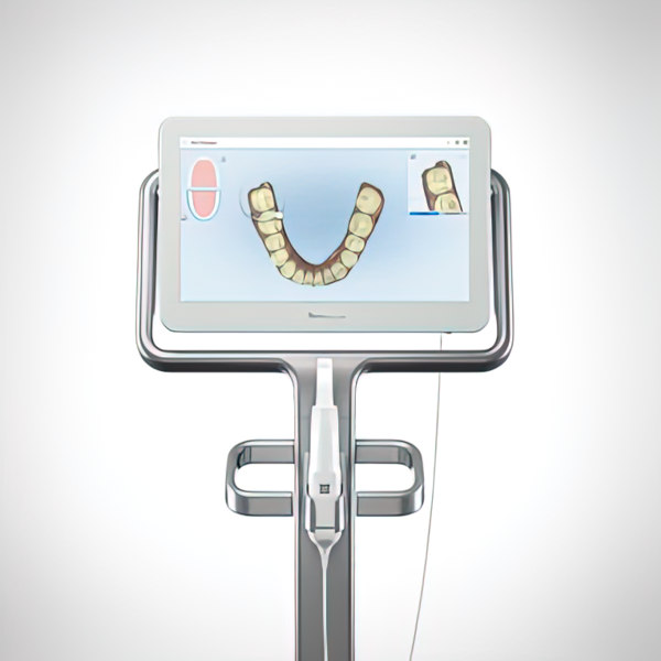 iTero® digital impression system machine