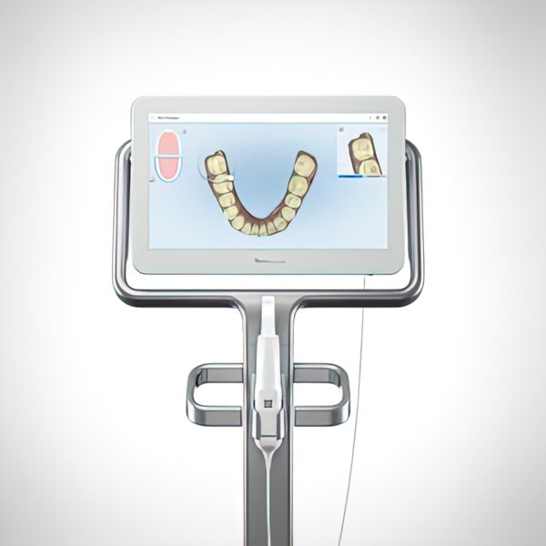 iTero® digital impression system machine