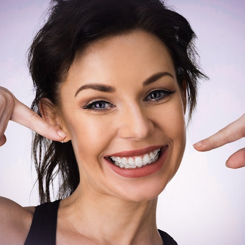 Smiling woman with clear ceramic braces