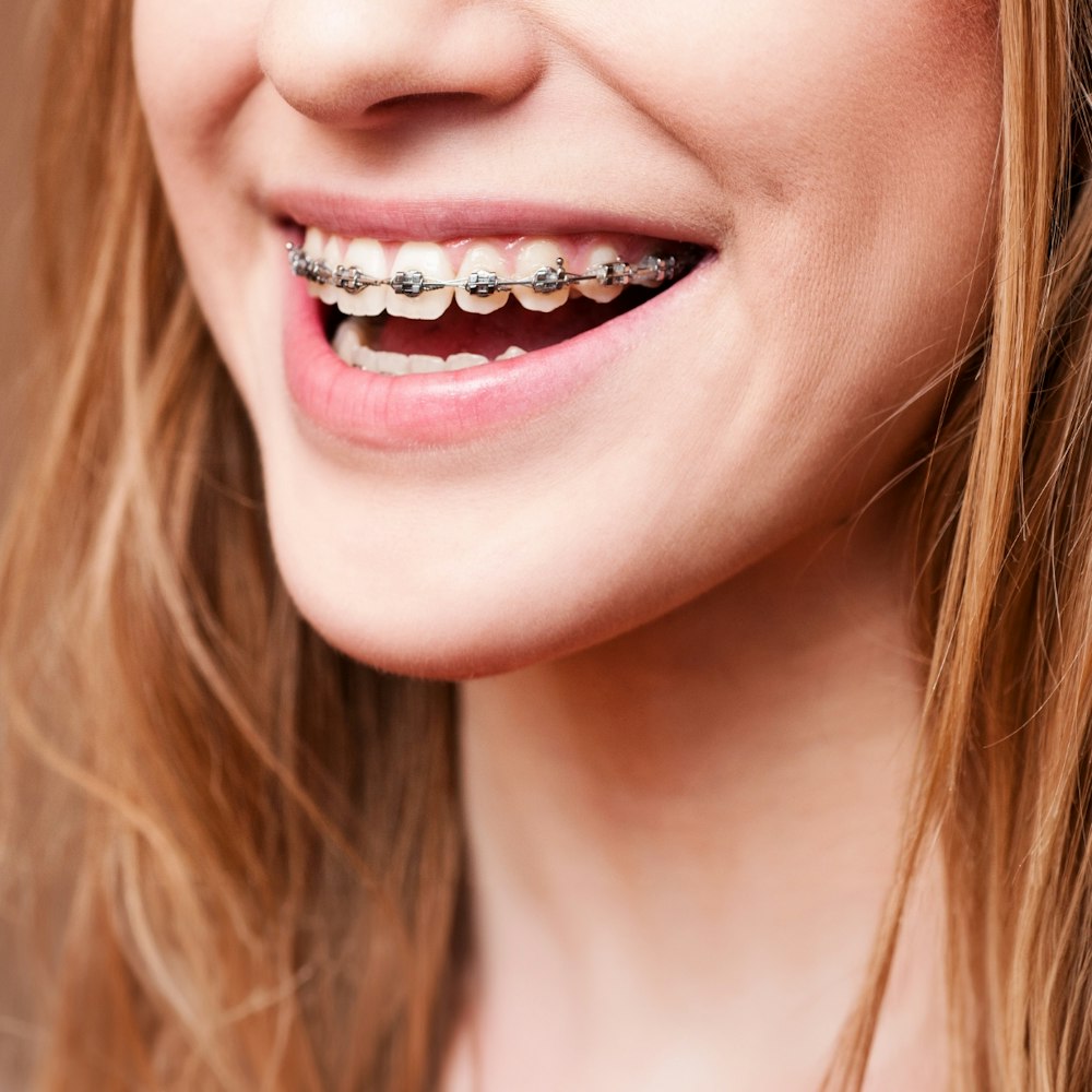 Close up of braces