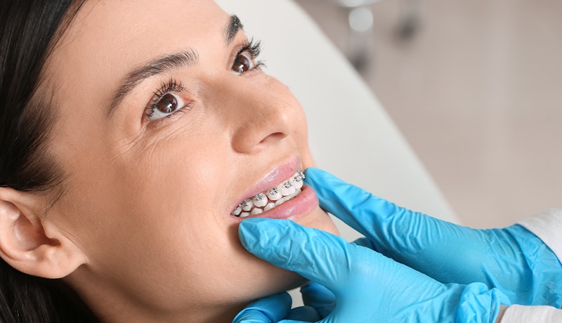 a dentist applying braces