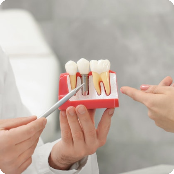 Implant prosthodontics