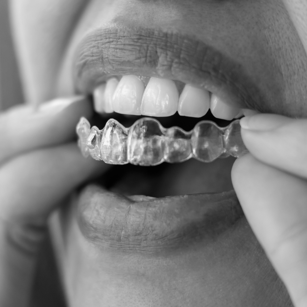 woman putting on invisalign