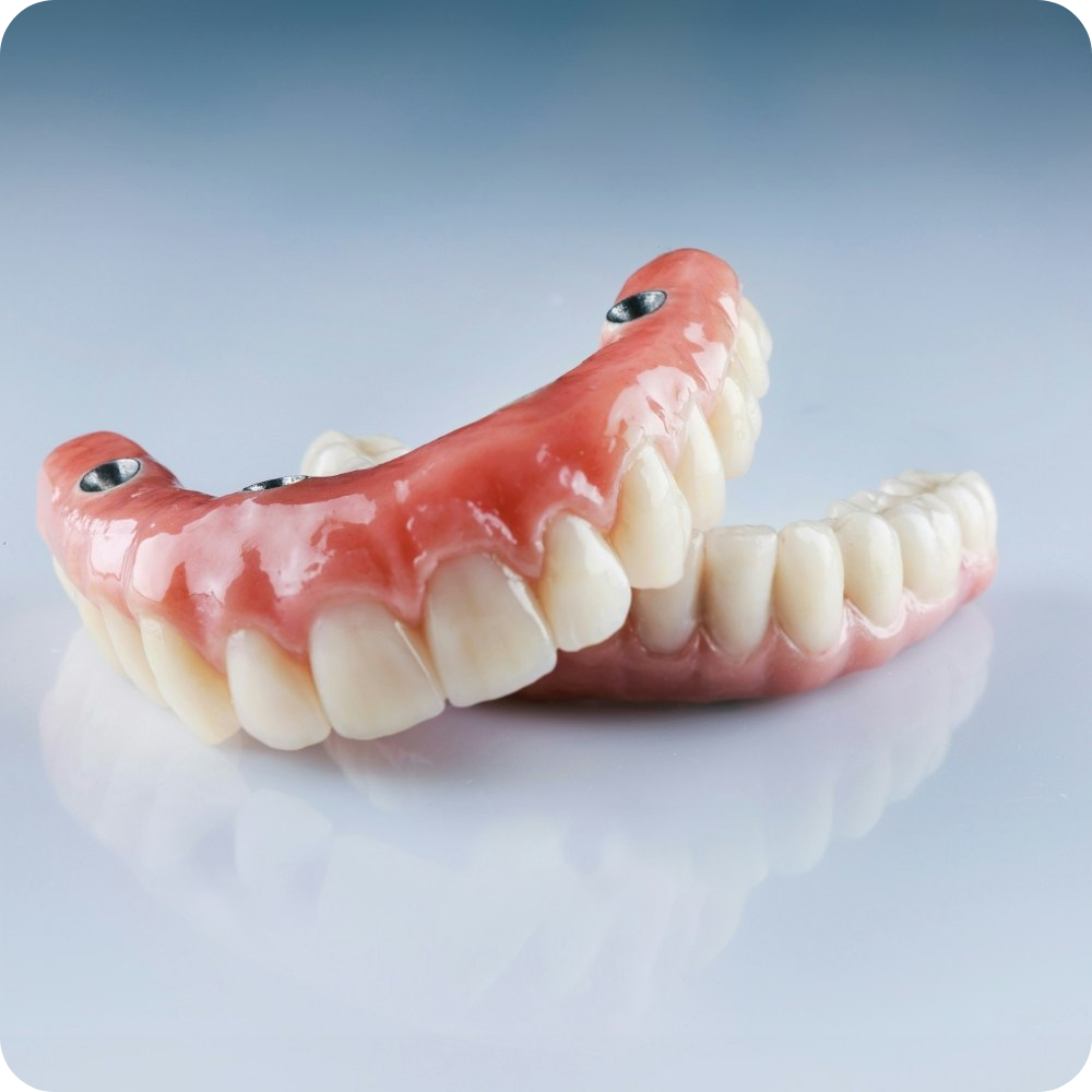 All-on-4 Implants