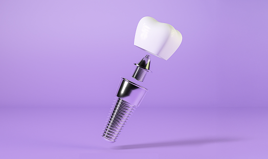 dental implant on purple background