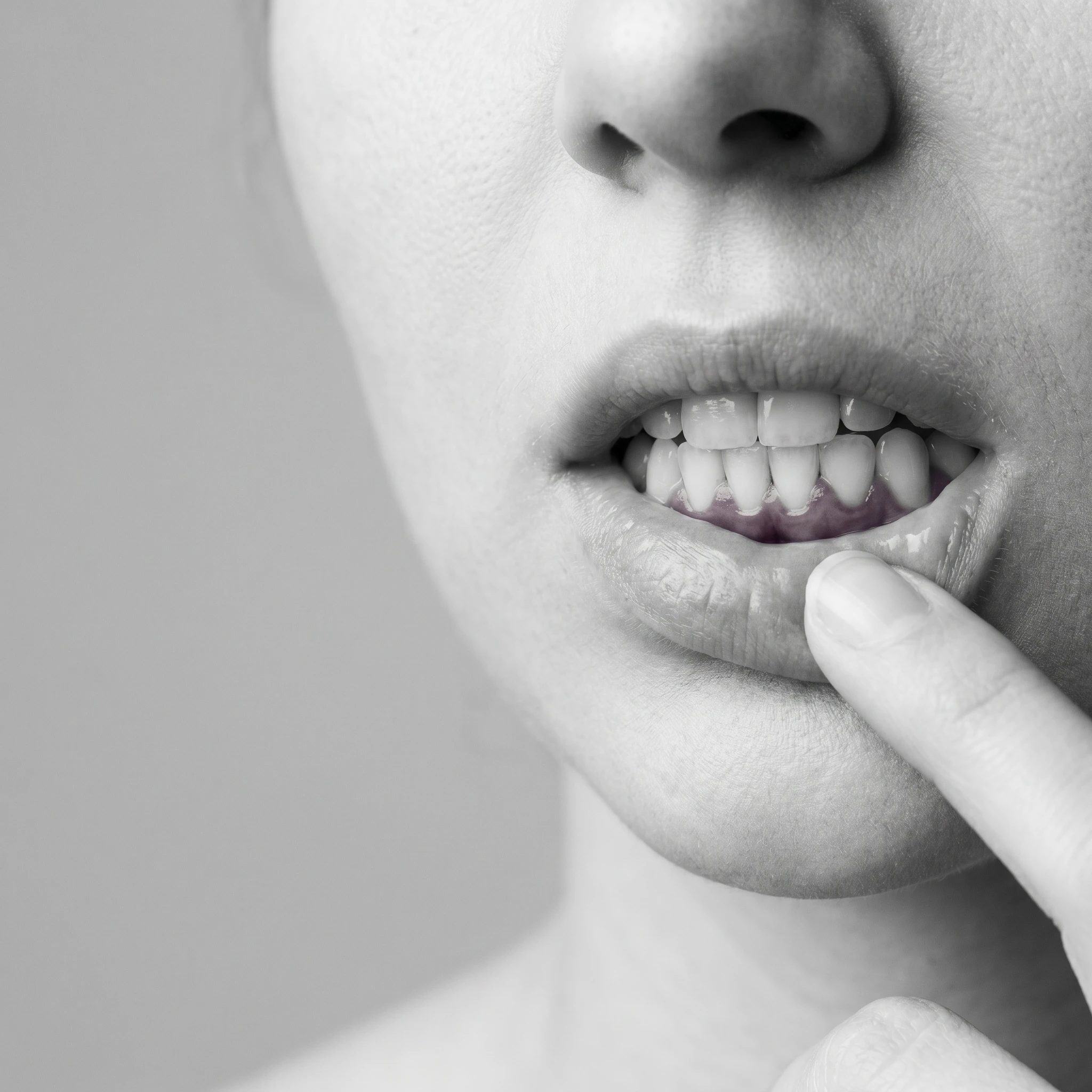 black and white picture of gum inflamation