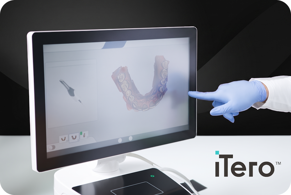iTero Intraoral Scanner